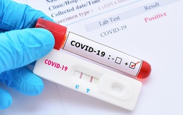 Có nên dùng test nhanh COVID-19 mua trên mạng?