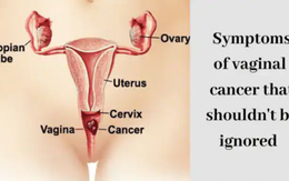 5 triệu chứng không thể bỏ qua của “ung thư âm đạo”