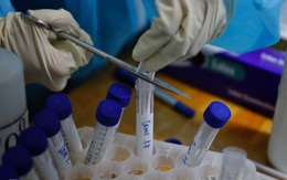 16 loại kit test nhanh kháng nguyên SARS-CoV-2 được Bộ Y tế cấp phép và giá bán