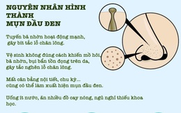 Nguyên nhân và cách cải thiện mụn đầu đen