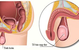 Nam giới cũng cần vệ sinh "vùng kín"