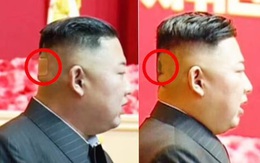 Miếng băng y tế lớn sau đầu Kim Jong-un gây chú ý