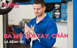 Ra mồ hôi chân, mồ hôi tay là bệnh gì?