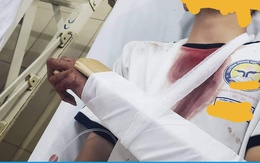 Nam sinh bị chém tới tấp ở TP.HCM