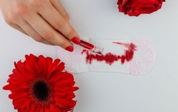 Những lưu ý khi chăm sóc sản phụ chảy máu sau sinh