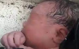 Chăm sóc bé gái sơ sinh bị bỏ rơi trong thùng xốp