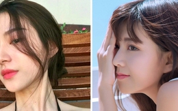 5 'đại kỵ' sau nâng mũi có thể khiến chị em gặp biến chứng nguy hiểm cho sức khỏe