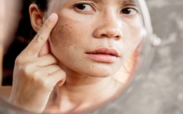 3 việc không nên quá chăm kẻo chưa 30 tuổi đã già như 60, bệnh tật đầy mình