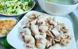 Khối u chiếm gần hết ruột chỉ vì những thói quen triệu người Việt Nam mắc