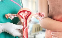Triệu chứng và cách phòng tránh bệnh ở tử cung