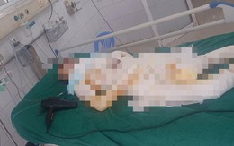 Vụ 3 con gái đổ xăng đốt nhà mẹ ruột ở Hưng Yên: Hé lộ tình trạng của người mẹ