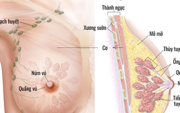 Ung thư vú: Các dấu hiệu nhận biết sớm