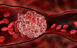 Mạch máu có 9 'nỗi sợ' vào mùa đông, bác sĩ cảnh báo người trên 40 tuổi cần cảnh giác
