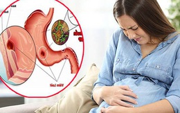 Đau dạ dày khi mang thai, nguyên nhân và cách xử trí