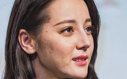 Kiểu ăn uống khiến da bạn siêu bẩn, mụn lên không kiểm soát và nhăn nheo, tiết lộ 2 thói quen ăn uống giúp da mềm mịn, sáng đẹp từ sâu bên trong