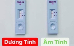 Cách phân biệt để biết kết quả test nhanh của bạn bị "dương tính giả"