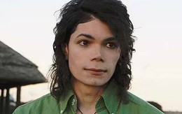 'Bản sao' Michael Jackson tuyên bố không phẫu thuật