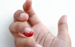 Vết cắn trên ngón tay vạch tội ác của kẻ giết bà bầu ở Mỹ