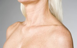 5 thói quen ngăn ngừa nếp nhăn vùng cổ