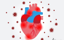 Di chứng tim mạch hậu F0 làm thế nào để hỗ trợ giảm nhẹ?