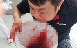 Hy hữu: Chảy máu mũi ồ ạt, chàng trai bưng xô hứng cầu cứu bác sĩ may mắn thoát chết