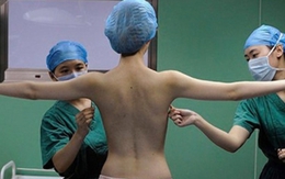 Choáng với phẫu thuật thu nhỏ ngực: Đang mổ bị dựng dậy chụp hình rồi mổ tiếp