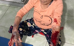 Góp ý hàng xóm hát karaoke quá to, cụ bà 83 tuổi bị đánh nhập viện