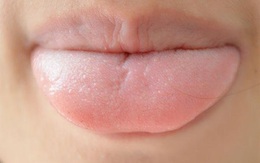 Nhìn lưỡi để biết sức khỏe, lưỡi có 4 thay đổi cho thấy bệnh tật đang xâm nhập vào cơ thể, cần đi khám kịp thời
