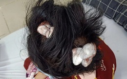 Vụ thiếu nữ 16 tuổi bị cha dượng đánh đập dã man: Lời kể đẫm nước mắt của người mẹ