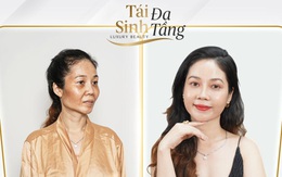 Tái sinh đa tầng - Tái tạo nhan sắc để nói lên sự sang trọng và quý phái của bạn