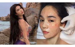 Ngọc Trinh lăng xê bộ môn chống lão hóa như... ma-cà-rồng, gương mặt nhìn thất kinh nhưng tự tin đẹp