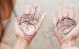 Rụng tóc, không phải lúc nào cũng đáng lo