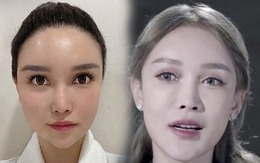 Chi 13 tỷ đồng thẩm mỹ từ lúc 14 tuổi, hot girl hàng đầu 1 thời bỗng ân hận
