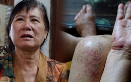 Chồng của người phụ nữ sống sót dưới vực sâu Yên Tử: 7 ngày đêm tuyệt vọng tìm vợ mất tích