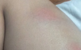 Bé gái 4 tuổi bị cô giáo đánh đập vì đi vệ sinh ra quần