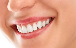 5 biện pháp làm trắng răng tại nhà