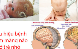 Những dấu hiệu nào báo hiệu bệnh viêm màng não ở trẻ em?