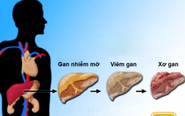 Mùa hè, gan thích nhất những thực phẩm này, nên bổ sung ngay để kéo dài tuổi thọ