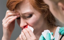 Chảy máu cam thường lành tính, nhưng nếu xuất hiện dấu hiệu này cần đi khám sớm