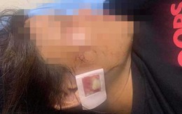 Thanh Hoá: Thông tin mới nhất người phụ nữ bị thương sau tiếng nổ lớn