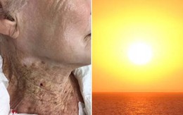 Bức ảnh về người phụ nữ 92 tuổi này là lời nhắc nhở nghiêm khắc cho việc dùng kem chống nắng