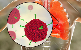 Thực hư virus Adeno khiến 6 trẻ tử vong nguy hiểm như thế nào? Chuyên gia khuyến cáo "mọi người cần bình tĩnh!"