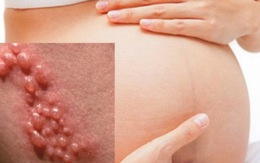 Những rủi ro khi mắc bệnh lậu ở phụ nữ mang thai