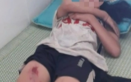 Xe đạp điện lao xuống suối, 3 học sinh thương vong