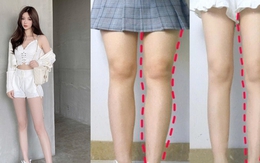 Chân "to như cột đình" triển ngay 4 động tác đơn giản này sẽ thấy chân thon gọn, tự tin diện váy vóc hơn