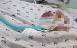 Vụ cháu bé 6 tháng tuổi bị bạo hành:  Vẫn hôn mê sâu, sức khỏe nguy kịch