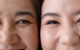 Cánh cửa mở ra tương lai cải lão hoàn đồng của con người