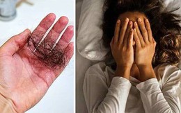 Chuyên gia cảnh báo thói quen làm tăng nguy cơ rụng tóc, khiến vi khuẩn phát triển