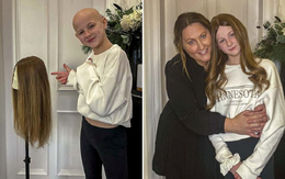 Căng thẳng kéo dài do bị bạn bắt nạt ở trường, cô bé mắc chứng rụng tóc