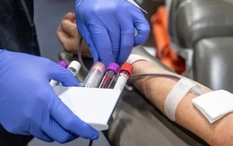 FDA đề xuất cho phép nam quan hệ đồng giới hiến máu